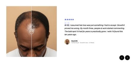 Image Comparison Success Stories